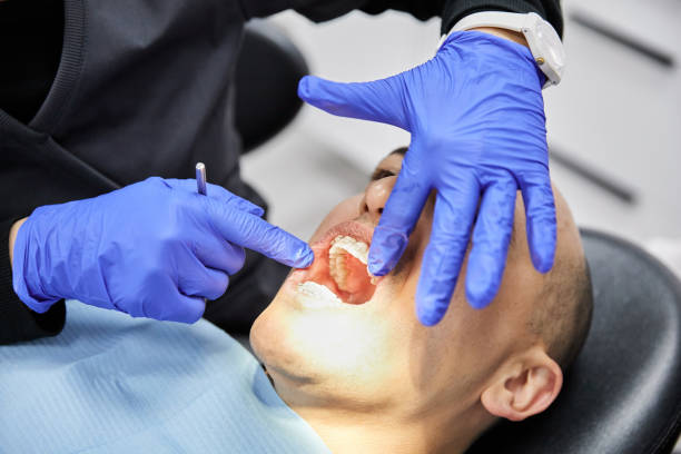 Best Emergency Dental Care for Abscessed Tooth in North Weeki Wachee, FL