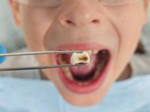 Best Orthodontic Emergency Dentist in North Weeki Wachee, FL